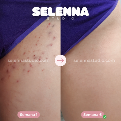 SELENNA IPL PRO™