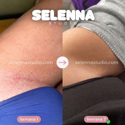 SELENNA IPL PRO™